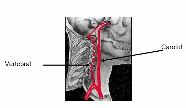 Risk of vertebrobasilar stroke and chiropractic care: results of a population-based case-control and case-crossover study
